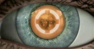 Cataract Surgery Long Beach, Atlantis Eyecare